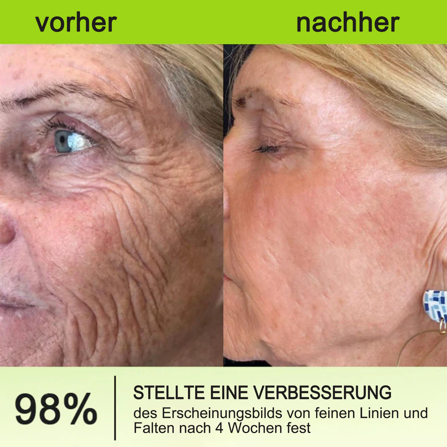 ✅Dr. Fachmer®👩‍⚕️ Peptid-Kollagen-Pflege für sofortige Straffung ⏰& Festigung – glättet augenblicklich Schwellungen und Fältchen und fördert bei regelmäßiger Anwendung eine straffere Haut.