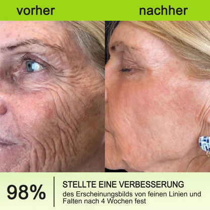 ✅Dr. Fachmer®👩‍⚕️ Peptid-Kollagen-Pflege für sofortige Straffung ⏰& Festigung – glättet augenblicklich Schwellungen und Fältchen und fördert bei regelmäßiger Anwendung eine straffere Haut.