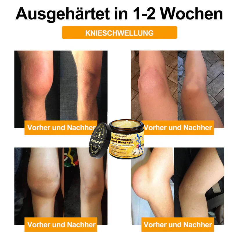 🇩🇪Offizieller Shop: Ourlyard® Bienengift-Schmerzlinderungs Knochenheilungs Creme 💥Deutsche orthopädische (DOUG) Zulassung(Reduzierung von Gelenkschwellungen, Schmerzen, Steifheit, Rötungen, Wärme, Muskelkater und Gelenkmüdigkeit)