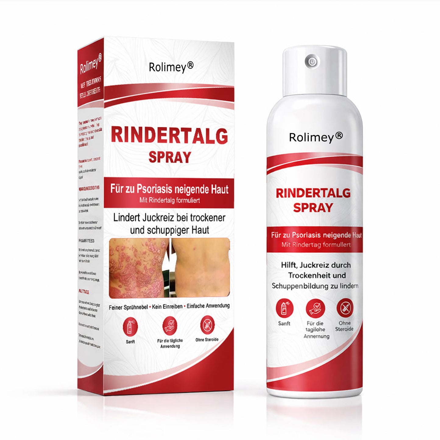 Rolimey® Rindertalg-Spray für juckende, schuppige Psoriasis-Haut 1