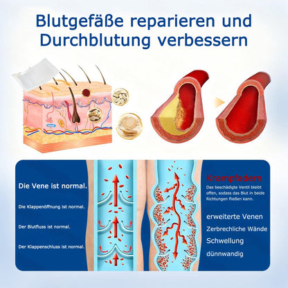 🇩🇪🔥 𝗚𝗙𝗢𝗨𝗞® 𝗩𝗲𝗶𝗻𝗧𝗮𝗿𝗴𝗲𝘁 𝗠𝗶𝗸𝗿𝗼𝗻𝗮𝗱𝗲𝗹-𝗣𝗳𝗹𝗮𝘀𝘁𝗲𝗿 ✅ 𝗦𝗼𝗳𝗼𝗿𝘁𝗶𝗴𝗲 𝗟𝗶𝗻𝗱𝗲𝗿𝘂𝗻𝗴, 𝗟𝗮𝗻𝗴𝗳𝗿𝗶𝘀𝘁𝗶𝗴𝗲 𝗘𝗿𝗴𝗲𝗯𝗻𝗶𝘀𝘀𝗲