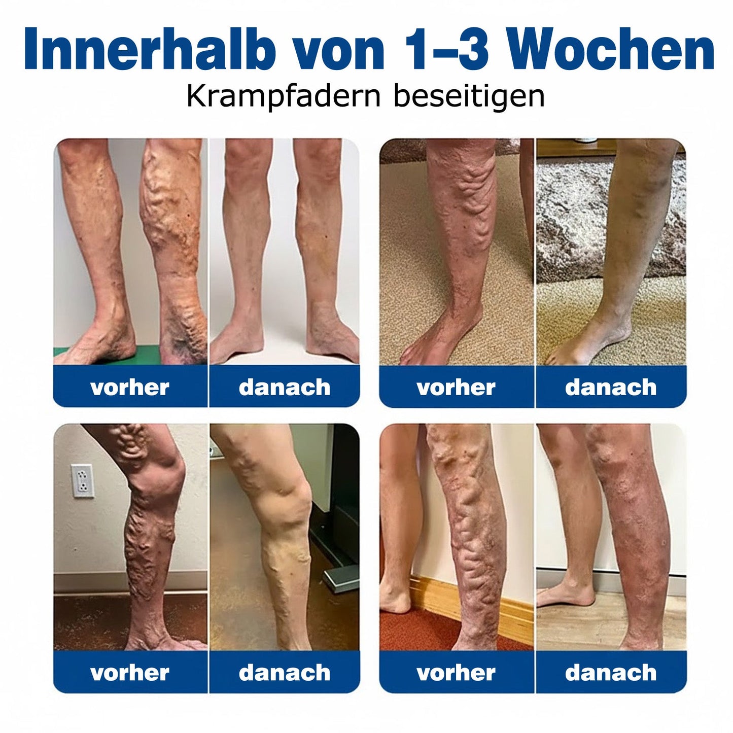 🇩🇪🔥 𝗚𝗙𝗢𝗨𝗞® 𝗩𝗲𝗶𝗻𝗧𝗮𝗿𝗴𝗲𝘁 𝗠𝗶𝗸𝗿𝗼𝗻𝗮𝗱𝗲𝗹-𝗣𝗳𝗹𝗮𝘀𝘁𝗲𝗿 ✅ 𝗦𝗼𝗳𝗼𝗿𝘁𝗶𝗴𝗲 𝗟𝗶𝗻𝗱𝗲𝗿𝘂𝗻𝗴, 𝗟𝗮𝗻𝗴𝗳𝗿𝗶𝘀𝘁𝗶𝗴𝗲 𝗘𝗿𝗴𝗲𝗯𝗻𝗶𝘀𝘀𝗲