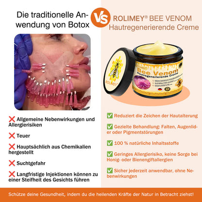 💎Rolimey® Bienengift Pro Umfassende Creme — 🔥Begrenzte Zeit 80 % RABATT🔥