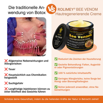 🎁🎁Neuestes Modell: Rolimey® Bienengift Max Pflegecreme – Reparatureffekt um 65 % gesteigert 🔥 NUR NOCH 80 % RABATT
