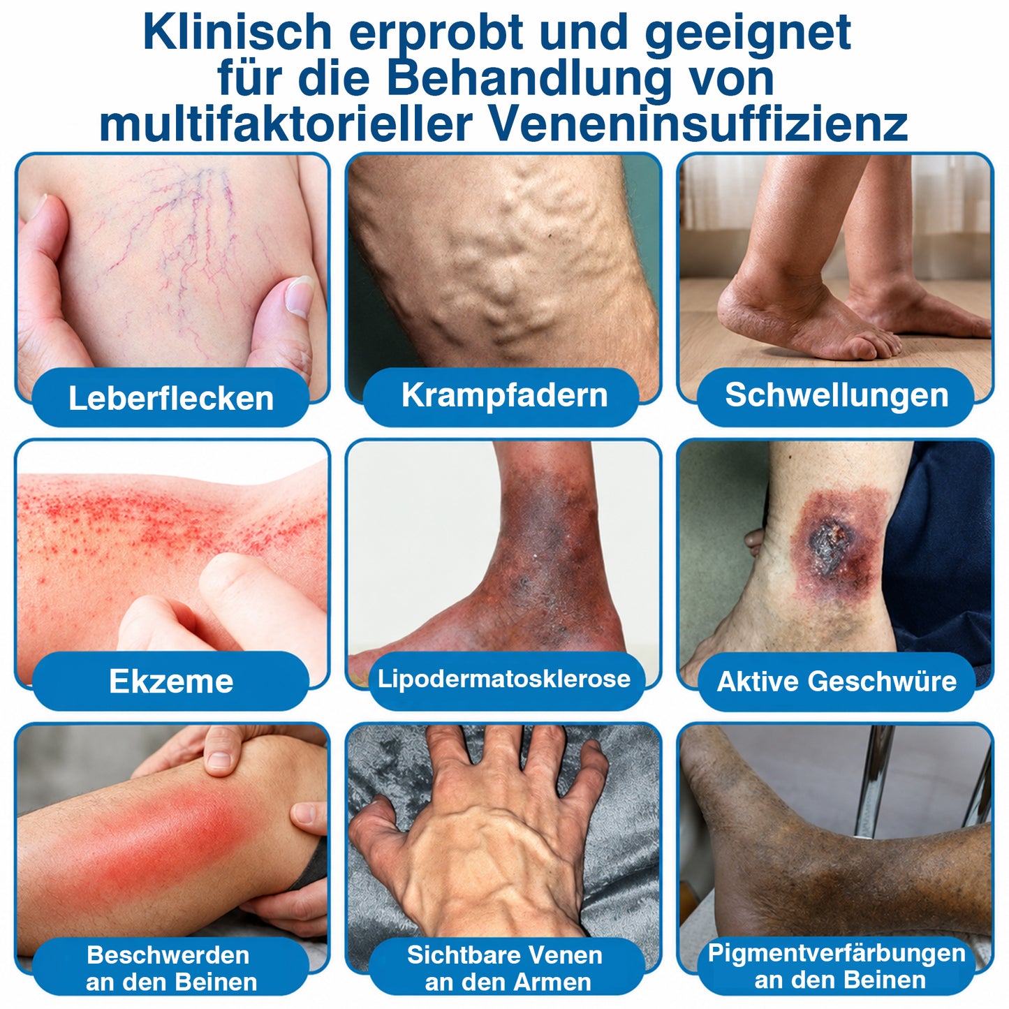 👨GFOUK® VeinRepair Mikronadel-Pflasterrolle ⚡ Sofortige Linderung, Langzeitergebnisse