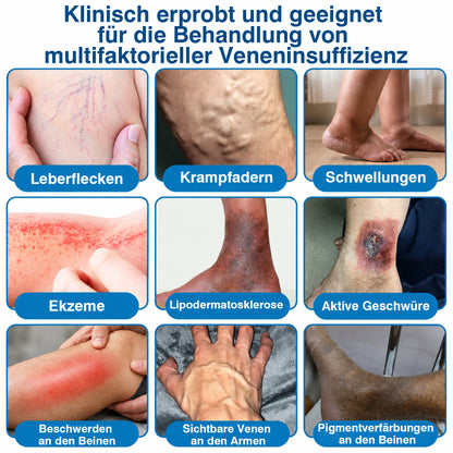 👨GFOUK® VeinRepair Mikronadel-Pflasterrolle ⚡ Sofortige Linderung, Langzeitergebnisse