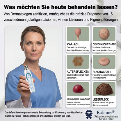 Rolimey® 7-Tage Tag- & Spot-Entferner🤍 (𝐙𝗲𝗿𝗼 𝐏𝗮𝗶𝗻, 𝐙𝗲𝗿𝗼 𝐒𝗰𝗮𝗿𝘀 Roll-On) ✅ Geeignet für: Hauttags, Flecken, Muttermale, Warzen, Blasen, Ekzeme, Schuppen, Hautkeratosen, Akne, Hautwucherungen, Narben, Geburtstagsmale 👩‍⚕️