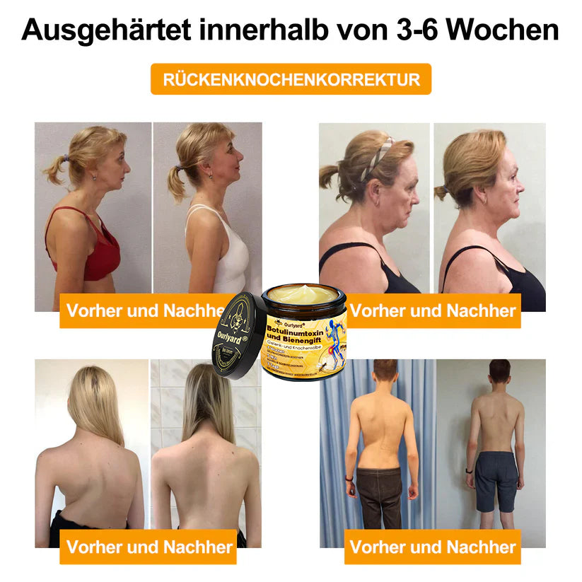 🇩🇪Offizieller Shop: Ourlyard® Bienengift-Schmerzlinderungs Knochenheilungs Creme 💥Deutsche orthopädische (DOUG) Zulassung(Reduzierung von Gelenkschwellungen, Schmerzen, Steifheit, Rötungen, Wärme, Muskelkater und Gelenkmüdigkeit)