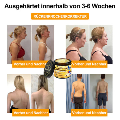 🇩🇪Offizieller Shop: Ourlyard® Bienengift-Schmerzlinderungs Knochenheilungs Creme 💥Deutsche orthopädische (DOUG) Zulassung(Reduzierung von Gelenkschwellungen, Schmerzen, Steifheit, Rötungen, Wärme, Muskelkater und Gelenkmüdigkeit)