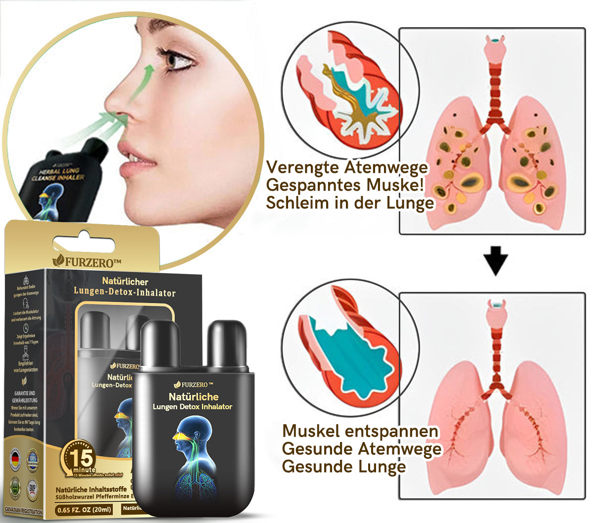 💖Offizieller Shop|🔥Furzero™ Natürlicher Lungen-Detox-Inhalator👨‍⚕️BfArM-certification(🎅 Weihnachts-Sonderangebot-💝LETZTER TAG 50% RABATT 💝)