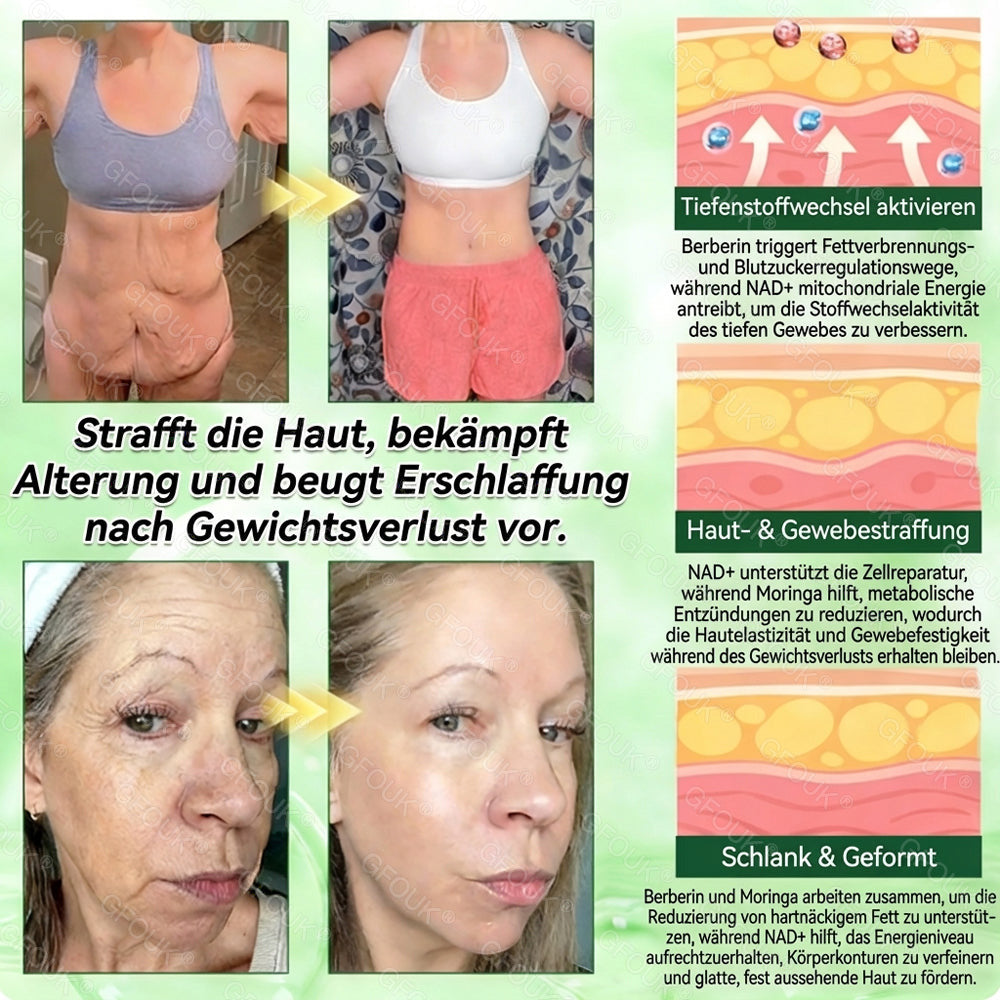 🍈🇩🇪𝗢𝗳𝗳𝗶𝘇𝗶𝗲𝗹𝗹𝗲𝗿 𝗦𝗵𝗼𝗽 | 🎁 𝗚𝗙𝗢𝗨𝗞® 𝗠𝗼𝗿𝗶𝗻𝗴𝗮 𝗕𝗲𝗿𝗯𝗲𝗿𝗶𝗻𝗲𝘅 𝗡𝗔𝗗+ 𝟭𝟬-𝗶𝗻-𝟭 𝗡𝗮𝗻𝗼-𝗠𝗶𝗸𝗿𝗼𝗻𝗮𝗱𝗲𝗹-𝗣𝗮𝘁𝗰𝗵 (𝗡𝘂𝗿 𝗲𝗶𝗻𝗺𝗮𝗹 𝘁ä𝗴𝗹𝗶𝗰𝗵, 𝘀𝗶𝗰𝗵𝘁𝗯𝗮𝗿𝗲 𝗩𝗲𝗿ä𝗻𝗱𝗲𝗿𝘂𝗻𝗴𝗲𝗻 𝗶𝗻 𝟳 𝗧𝗮𝗴𝗲𝗻) ✅ 𝗙ü𝗿 Ü𝗯𝗲𝗿𝗴𝗲𝘄𝗶𝗰𝗵𝘁, 𝗹𝗼𝗰𝗸𝗲𝗿𝗲 𝗛𝗮𝘂𝘁, 𝗗𝗶𝗮𝗯𝗲𝘁𝗲𝘀, 𝗦𝗰𝗵𝗹𝗮𝗳𝗮𝗽𝗻𝗼𝗲, 𝗚𝗲𝗹𝗲𝗻𝗸𝗽𝗿𝗼𝗯𝗹𝗲𝗺𝗲 𝘂𝗻𝗱 𝗺𝗲𝗵𝗿