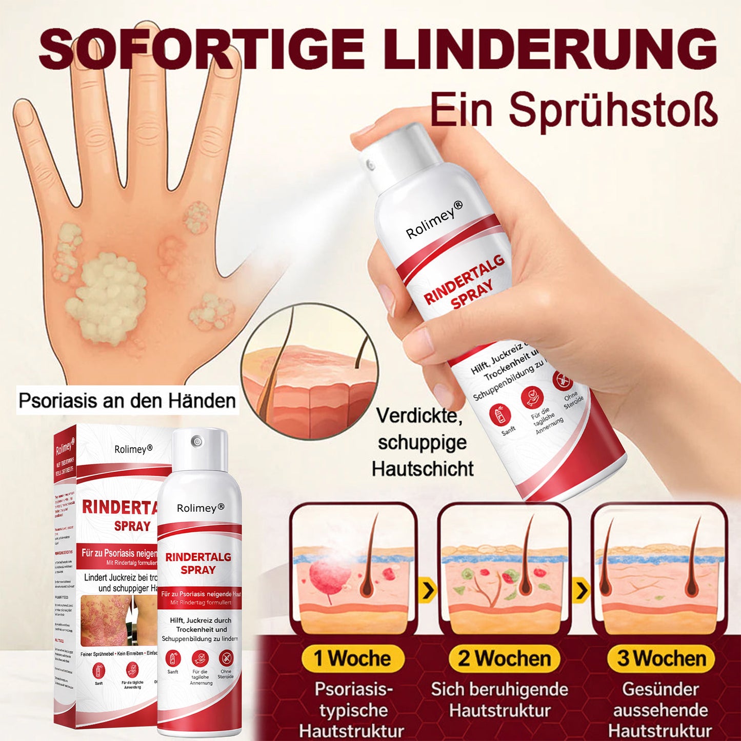 Rolimey® Rindertalg-Spray für juckende, schuppige Psoriasis-Haut 1