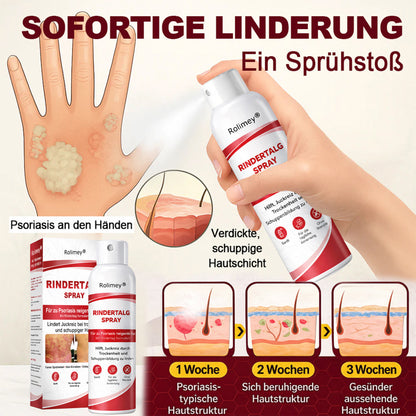 Rolimey® Rindertalg-Spray für juckende, schuppige Psoriasis-Haut 1
