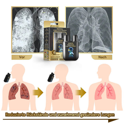 💕Offizieller Shop|🔥Ourlyard™ Natürlicher Lungen-Detox-Inhalator👨‍⚕️BfArM-certification(🎅 Weihnachts-Sonderangebot-💝LETZTER TAG 50% RABATT 💝)
