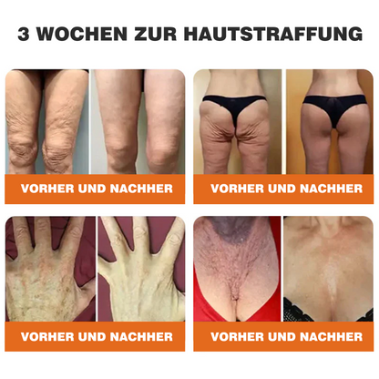 🎁🎁Neuestes Modell: Rolimey® Bienengift Max Pflegecreme – Reparatureffekt um 65 % gesteigert 🔥 NUR NOCH 80 % RABATT