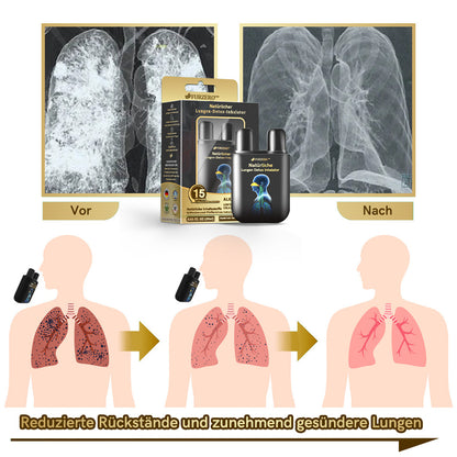 💖Offizieller Shop|🔥Furzero™ Natürlicher Lungen-Detox-Inhalator👨‍⚕️BfArM-certification(🎅 Weihnachts-Sonderangebot-💝LETZTER TAG 50% RABATT 💝)