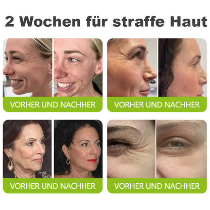 🇩🇪Jetzt jugendliche Haut zurückgewinnen💟Cvreoz® Botox & Vita-A Retinol Shot Falten-Lift Straffungscreme