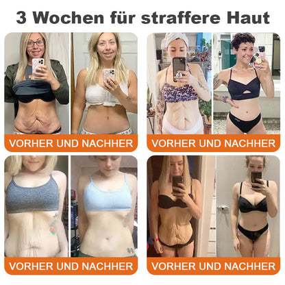🌲🇩🇪Hergestellt in Deutschland🌲Rolimey® Botox-Bienenvergiftungsstraffungsserum-Stick🔥LETZTER TAG 70% RABATT