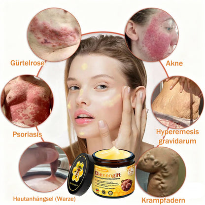 🌟Hergestellt und versendet aus Deutschland💖  Ourlyard® Bienengift Hautregenerationscreme 🔥 LETZTER TAG 80 % RABATT 🌟