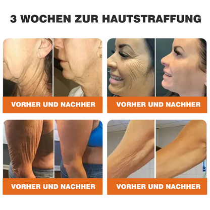 🎁🎁Neuestes Modell: Rolimey® Bienengift Max Pflegecreme – Reparatureffekt um 65 % gesteigert 🔥 NUR NOCH 80 % RABATT