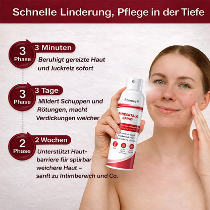 Rolimey® Rindertalg-Spray für juckende, schuppige Psoriasis-Haut 1