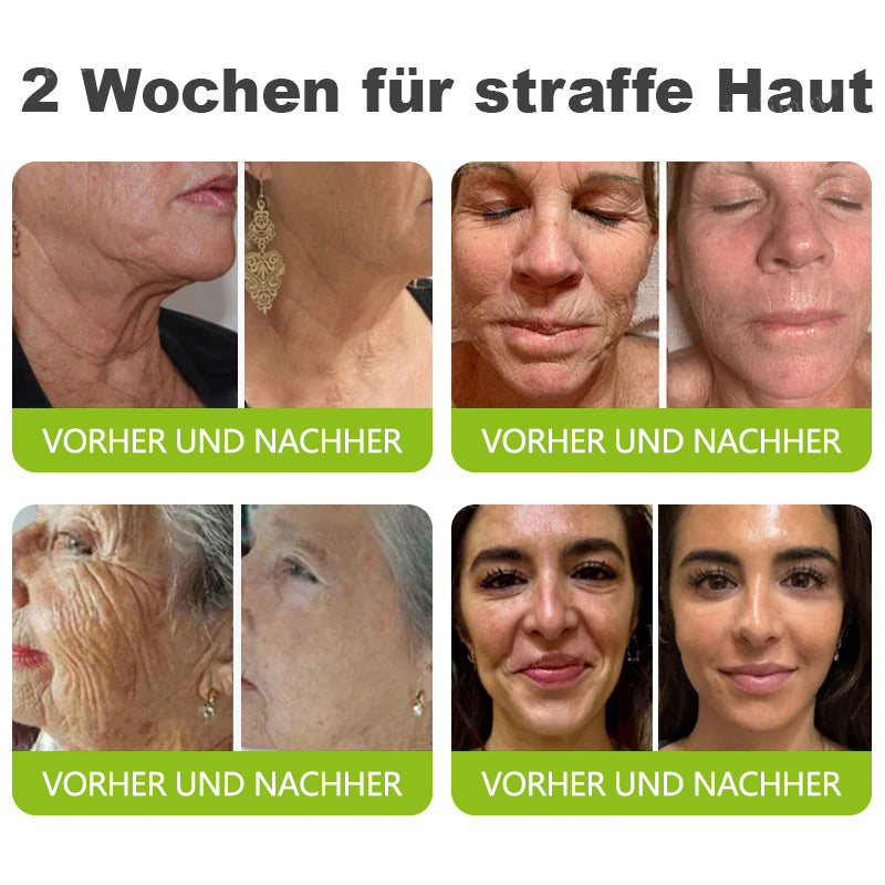 🇩🇪Jetzt jugendliche Haut zurückgewinnen💟Cvreoz® Botox & Vita-A Retinol Shot Falten-Lift Straffungscreme