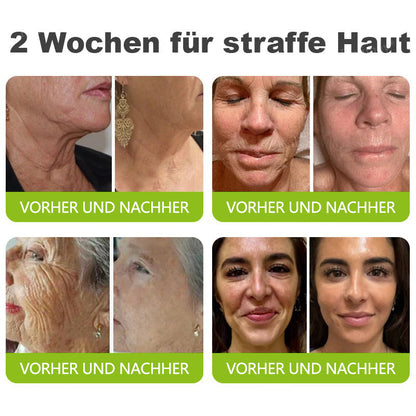 🇩🇪Jetzt jugendliche Haut zurückgewinnen💟Cvreoz® Botox & Vita-A Retinol Shot Falten-Lift Straffungscreme