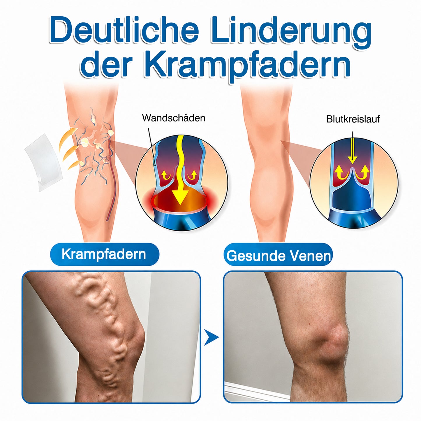 👨GFOUK® VeinRepair Mikronadel-Pflasterrolle ⚡ Sofortige Linderung, Langzeitergebnisse
