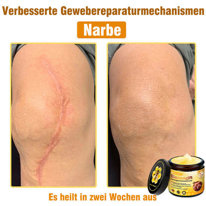 🌟Hergestellt und versendet aus Deutschland💖  Ourlyard® Bienengift Hautregenerationscreme 🔥 LETZTER TAG 80 % RABATT 🌟
