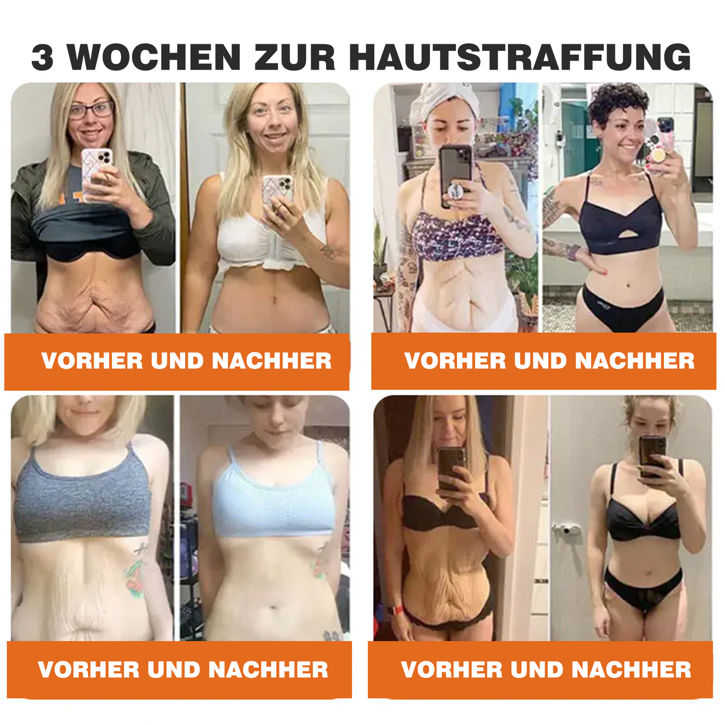 🎁🎁Neuestes Modell: Rolimey® Bienengift Max Pflegecreme – Reparatureffekt um 65 % gesteigert 🔥 NUR NOCH 80 % RABATT