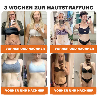 🎁🎁Neuestes Modell: Rolimey® Bienengift Max Pflegecreme – Reparatureffekt um 65 % gesteigert 🔥 NUR NOCH 80 % RABATT