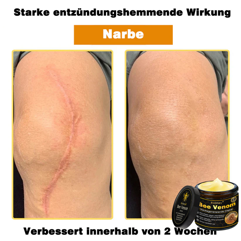 🎁🎁Neuestes Modell: Rolimey® Bienengift Max Pflegecreme – Reparatureffekt um 65 % gesteigert 🔥 NUR NOCH 80 % RABATT
