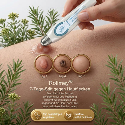 Rolimey® 7-Tage Tag- & Spot-Entferner🆕 (𝐙𝗲𝗿𝗼 𝐏𝗮𝗶𝗻, 𝐙𝗲𝗿𝗼 𝐒𝗰𝗮𝗿𝘀 Roll-On) ✅ Geeignet für: Hauttags, Flecken, Muttermale, Warzen, Blasen, Ekzeme, Schuppen, Hautkeratosen, Akne, Hautwucherungen, Narben, Geburtstagsmale 👩‍⚕️