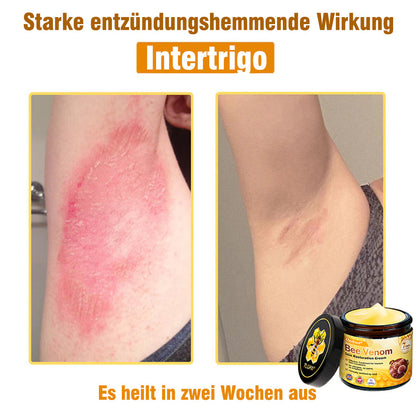 🌟Hergestellt und versendet aus Deutschland💖  Ourlyard® Bienengift Hautregenerationscreme 🔥 LETZTER TAG 80 % RABATT 🌟