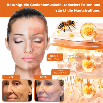 🎁🎁Neuestes Modell: Rolimey® Bienengift Max Pflegecreme – Reparatureffekt um 65 % gesteigert 🔥 NUR NOCH 80 % RABATT