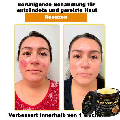 🎁🎁Neuestes Modell: Rolimey® Bienengift Max Pflegecreme – Reparatureffekt um 65 % gesteigert 🔥 NUR NOCH 80 % RABATT