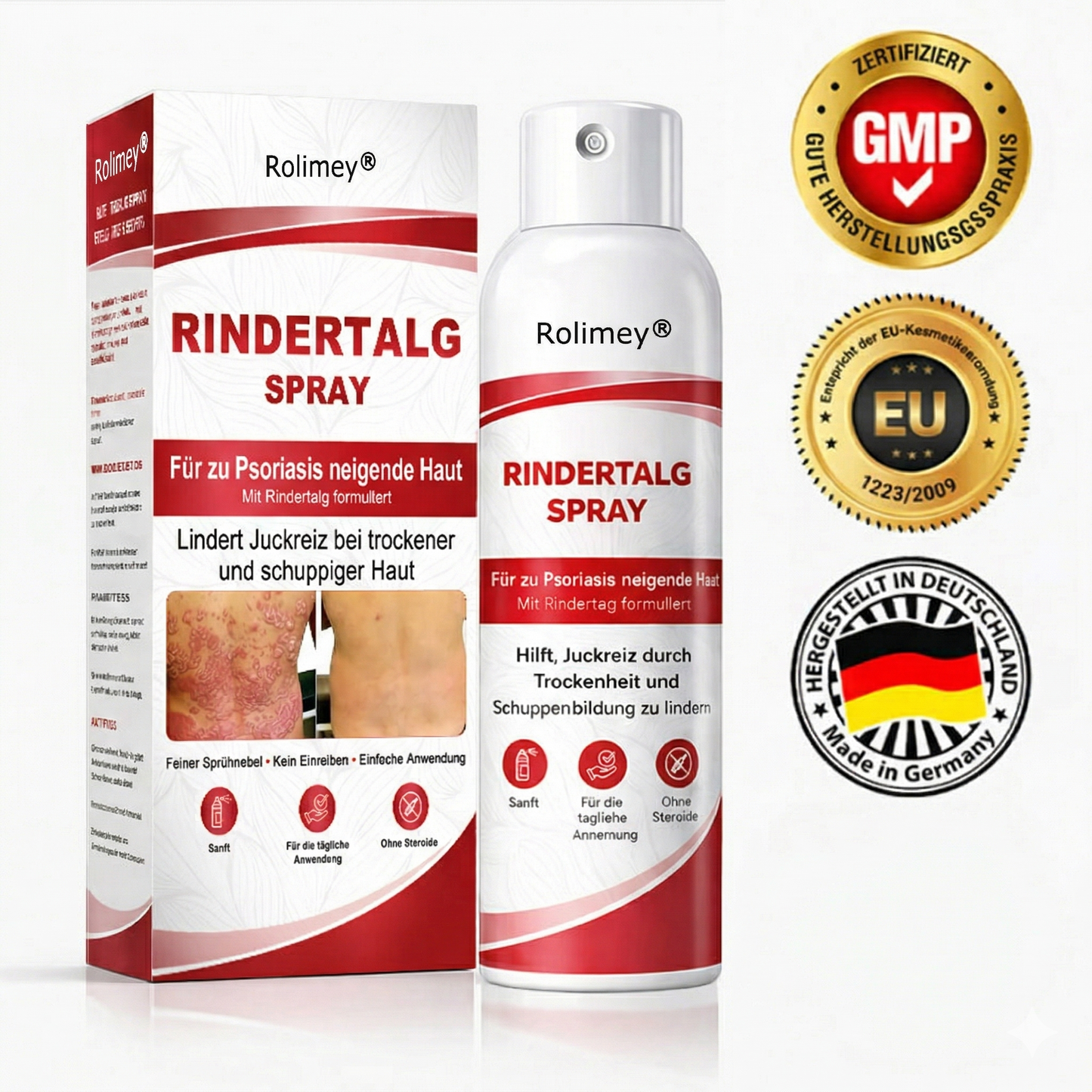 Rolimey® Rindertalg-Spray für juckende, schuppige Psoriasis-Haut 1