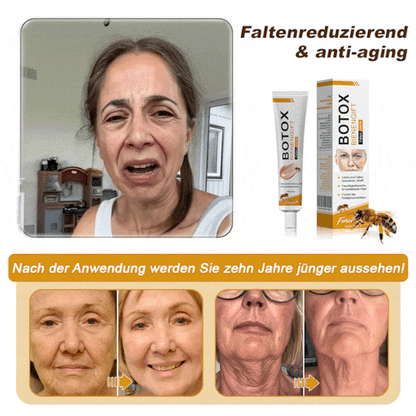 🐝🐝𝐎𝐟𝐟𝐢𝐳𝐢𝐞𝐥𝐥𝐞𝐫 𝐒𝐭𝐨𝐫𝐞 | Letzter Tag der Aktion: 70 % Rabatt - ✨Furzero™ Botox Bienenvenom Faltenentfernungscreme