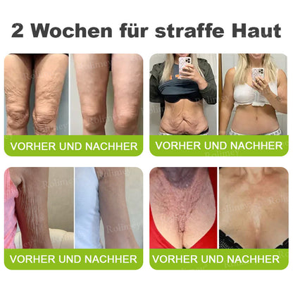 ✅Jetzt jugendliche Haut zurückgewinnen 💫Rolimey® Botox & Vita-A Retinol Shot Falten-Lift Straffungscreme